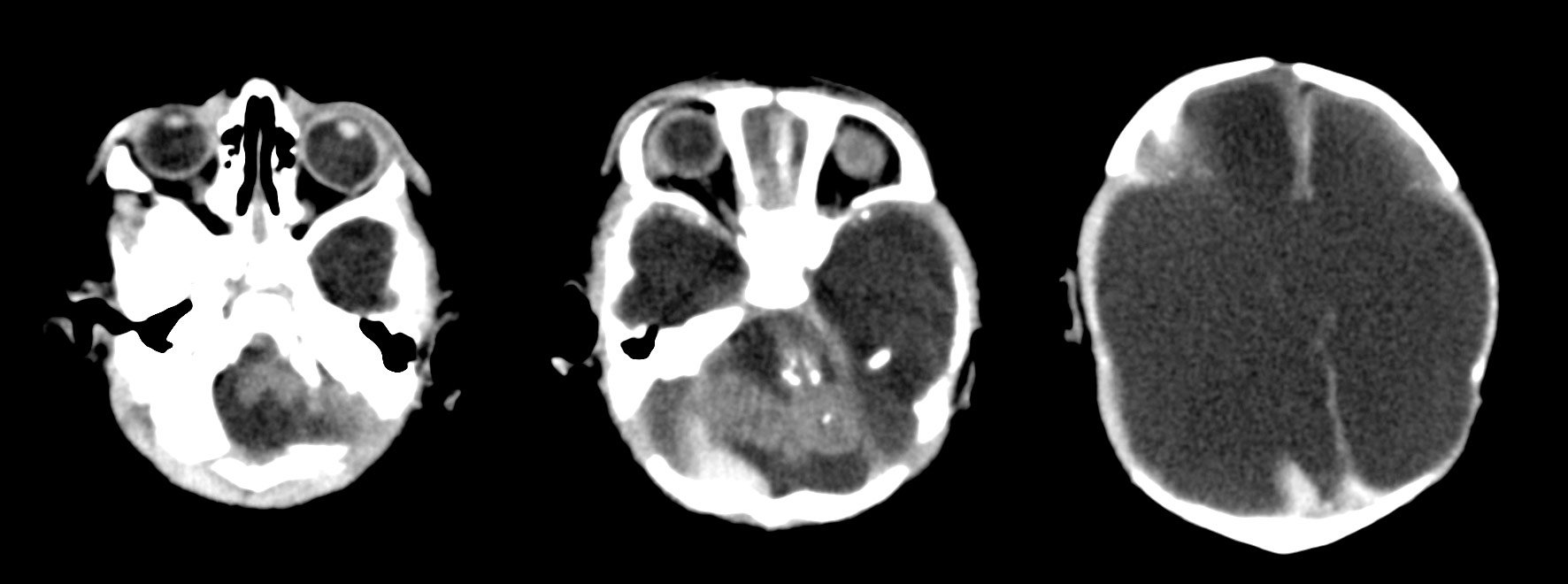 -zika-radiology-image-4-superJumbo